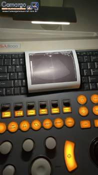 Aparelho de ultrassonografia Medison Sansung